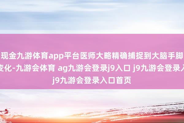 现金九游体育app平台医师大略精确捕捉到大脑手脚的蓦地变化-九游会体育 ag九游会登录j9入口 j9九游会登录入口首页